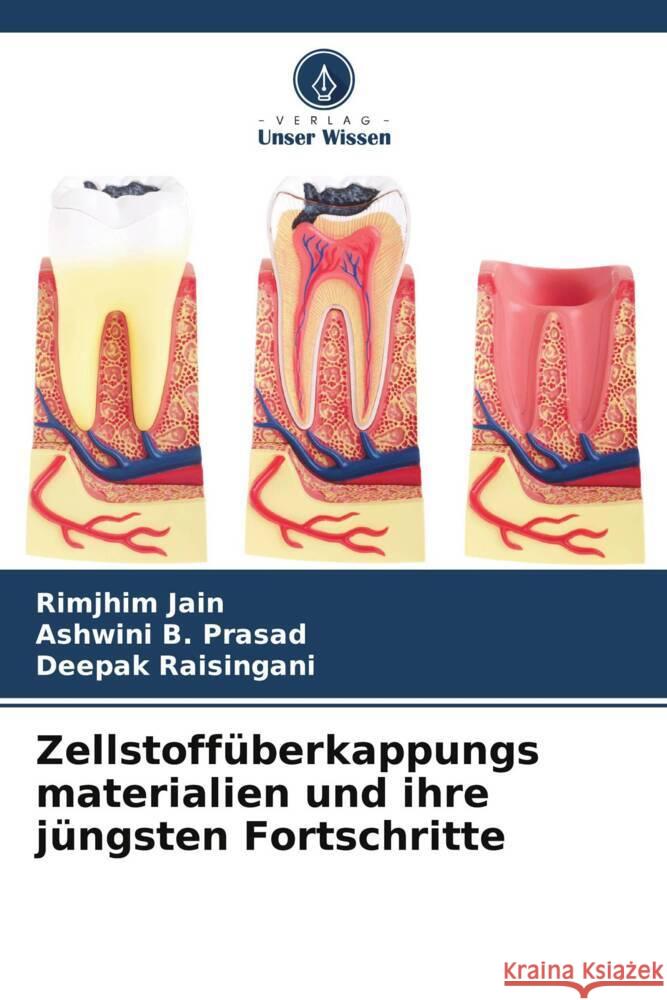 Zellstoffüberkappungs materialien und ihre jüngsten Fortschritte Jain, Rimjhim, B. Prasad, Ashwini, Raisingani, Deepak 9786205594407 Verlag Unser Wissen - książka