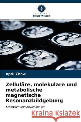 Zelluläre, molekulare und metabolische magnetische Resonanzbildgebung April Chow 9786203092103 Verlag Unser Wissen - książka