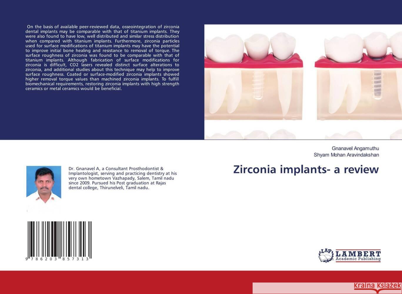 Zirconia implants- a review Angamuthu, Gnanavel, Aravindakshan, Shyam Mohan 9786203857313 LAP Lambert Academic Publishing - książka