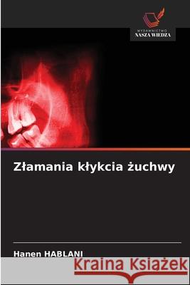 Zlamania klykcia zuchwy HABLANI, Hanen 9786209046612 Wydawnictwo Nasza Wiedza - książka