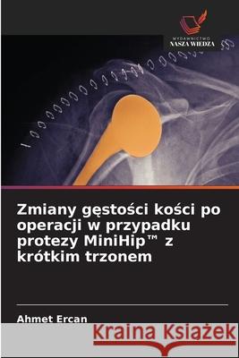 Zmiany gestosci kosci po operacji w przypadku protezy MiniHip(TM) z krótkim trzonem Ercan, Ahmet 9786206818762 Wydawnictwo Nasza Wiedza - książka