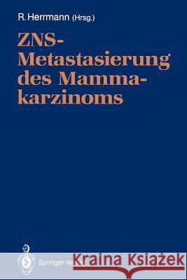 ZNS-Metastasierung des Mammakarzinoms D. Huhn, Richard Herrmann 9783540535751 Springer-Verlag Berlin and Heidelberg GmbH &  - książka