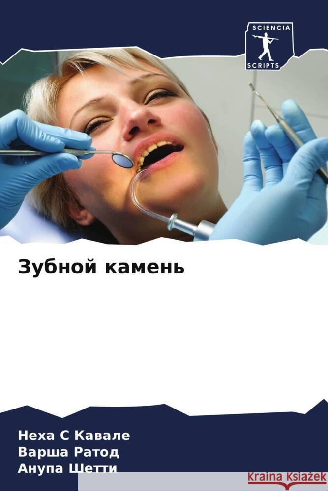 Zubnoj kamen' Kawale, Neha S, Ratod, Varsha, Shetti, Anupa 9786204795287 Sciencia Scripts - książka