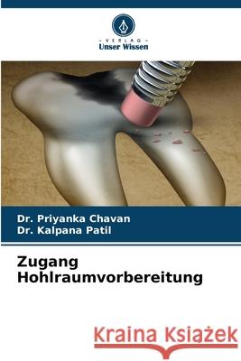 Zugang Hohlraumvorbereitung Chavan, Dr. Priyanka, Patil, Dr. Kalpana 9786135611397 Verlag Unser Wissen - książka