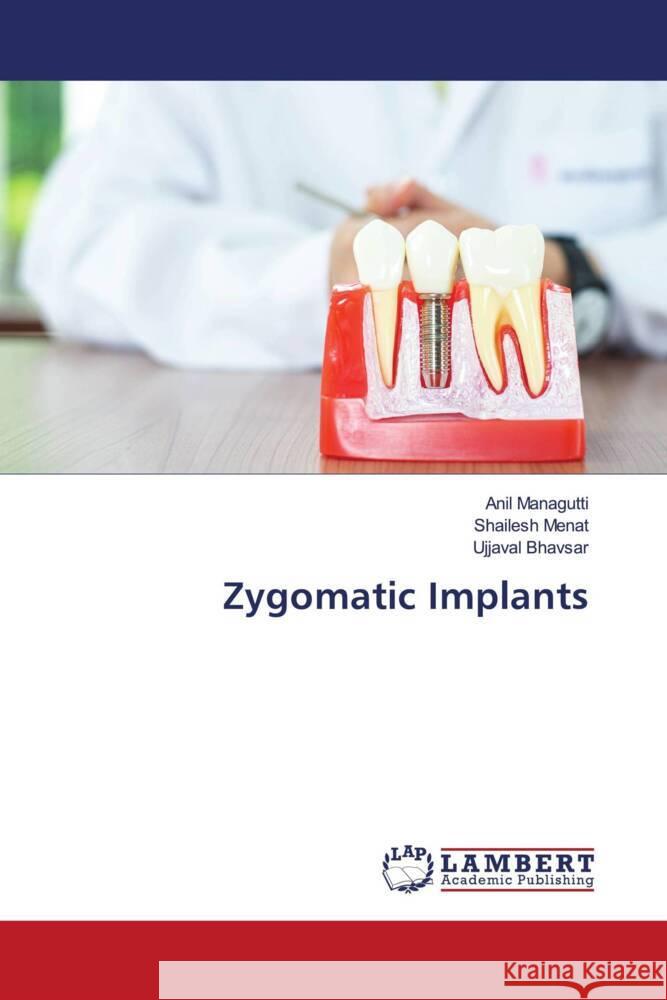 Zygomatic Implants Managutti, Anil, Menat, Shailesh, Bhavsar, Ujjaval 9786204984766 LAP Lambert Academic Publishing - książka